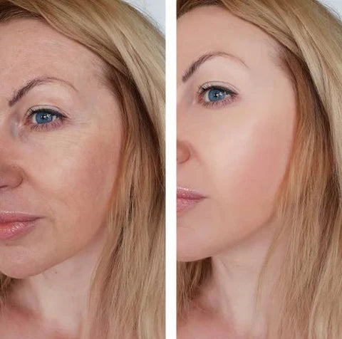 Magic Cream Face Lift